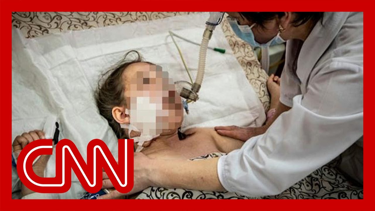 Heartbreaking images show wounded children in Ukraine hospital