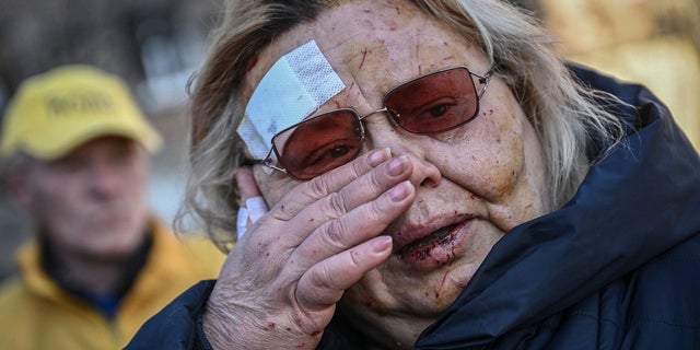 An injured woman reacts after shelling in a residential area in Kyiv March 18, 2022, as Russian troops try to encircle the Ukrainian capital as part of their slow-moving offensive. 