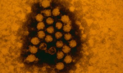 Why a Coronavirus-Flu ‘Twindemic’ May Never Happen