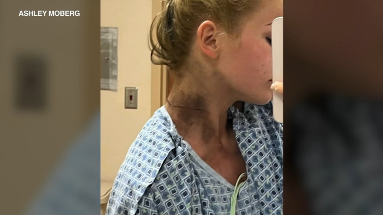 Elmhurst dad, daughter describe moment they were struck by lightning: ‘I thought my dad was dead’