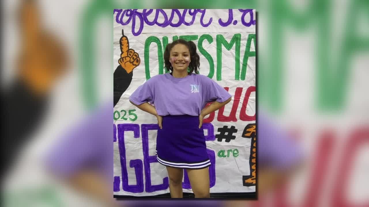 Charges filed in death of Texas teen who suffered severe burn injuries