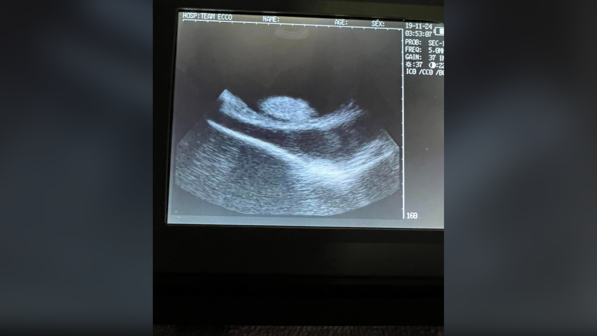 X-ray of pregnant stingray
