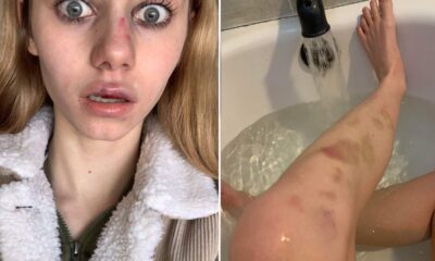 Bullied NJ student's family sues school officials who 'created culture of violence' before girl's suicide