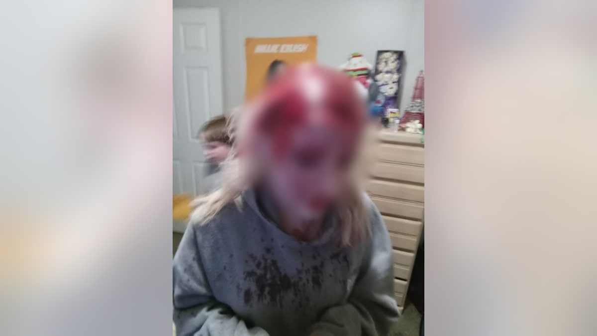 A blurred photo of blood covering Emma Filback's head