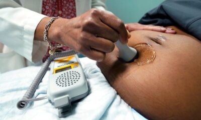 Planned Parenthood suffers loss in legal challenge to South Carolina's fetal heartbeat law