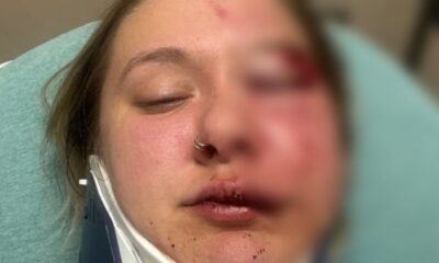 Woman just dropped off by Uber brutally beaten in random attack