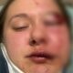 Woman just dropped off by Uber brutally beaten in random attack