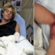 Florida teen surfer attacked by shark, says it ‘could have been so much worse’