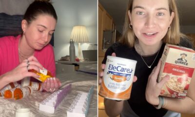Woman who is 'allergic to everything' can only eat these 2 things