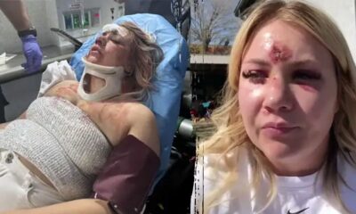 Bride-to-be left with broken nose, teeth after brutal bachelorette attack: police