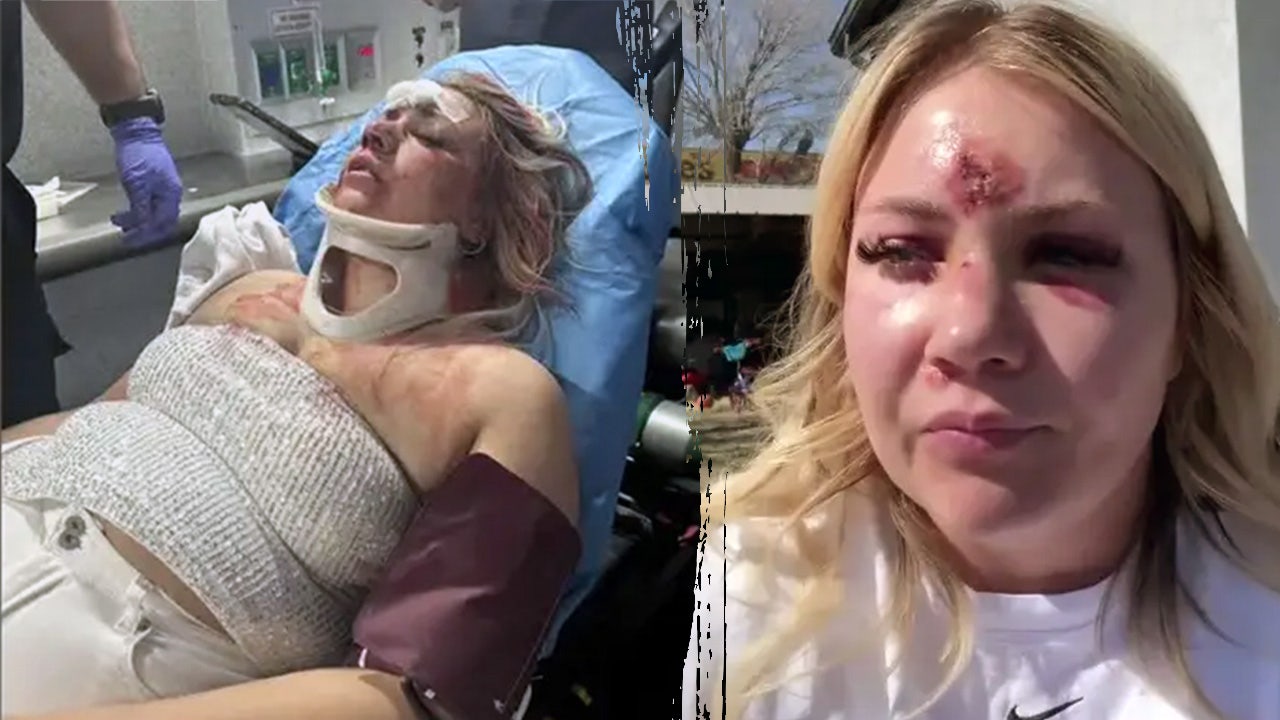 Bride-to-be left with broken nose, teeth after brutal bachelorette attack: police Bride-to-be left with broken nose, teeth after brutal bachelorette attack: police