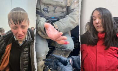 Anti-ICE agitator allegedly bites off federal officer’s finger during Minneapolis attack